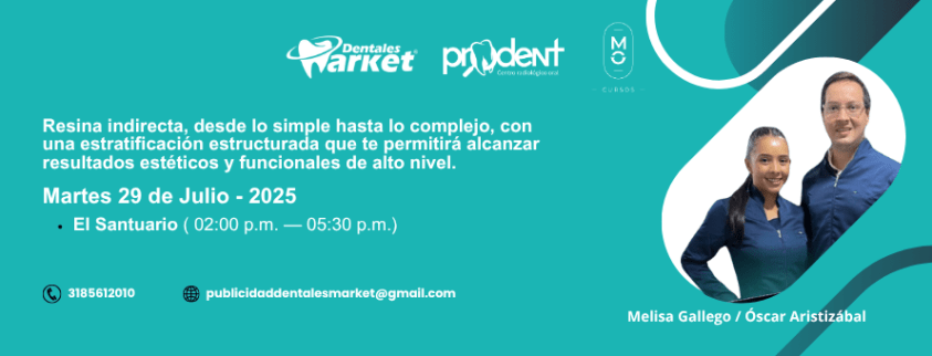 Resina indirecta desde lo simple a lo complejo. Conociendo una estratificación predecible para alcanzar excelentes resultados.